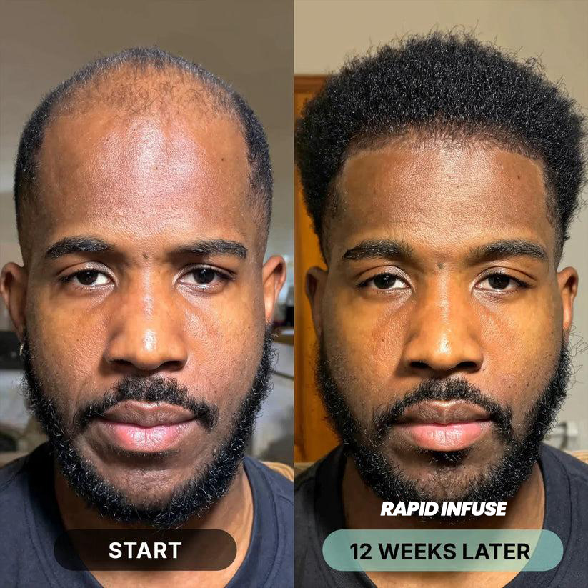 Before and after hair results 2