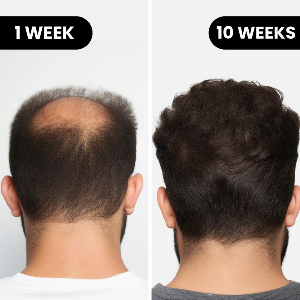 Before and after hair results 3